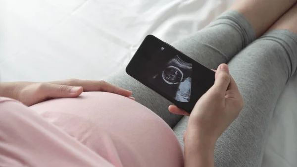 赤ちゃんを待っている女性 妊娠中の女性は彼女の超音波スキャン写真をスマートフォンで見ています 妊娠の概念 妊産婦のケア — ストック写真
