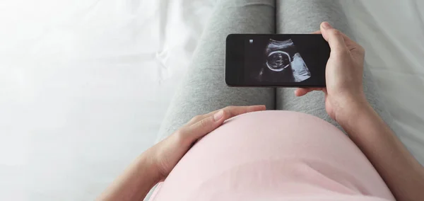 Mulher Esperando Seu Bebê Mulher Grávida Olhando Sua Foto Ultra — Fotografia de Stock