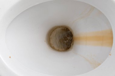 close-up dirty toilet bowl, traces of limescale and rust clipart