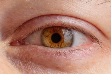 Kahverengi renkli insan gözbebeği.