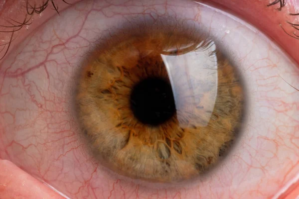 human pupil close up, blood vessels in the white of the eye