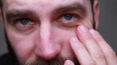 Mükemmellik erkekler için bile zor bir iştir. Şımartma, yaşlanma, yağlı, kuru cilt konsepti, yanağına dokunan endişeli adamın portresi, muayene, uzman yüz derisi.