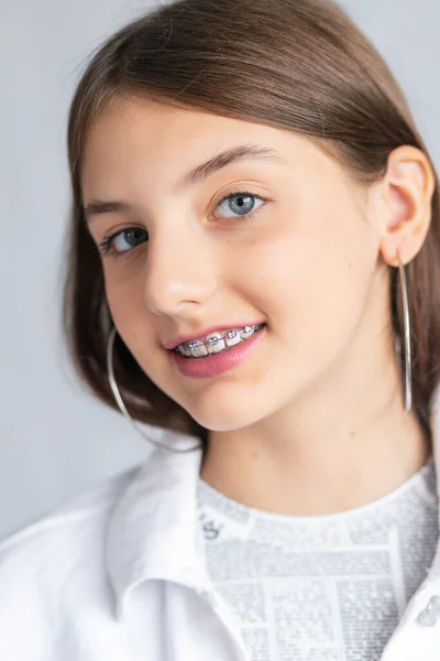 Face Young Woman Braces Her Teeth Healthy Smile — Stock Photo, Image