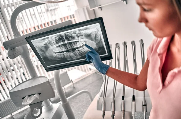 Imagen Del Médico Dentista Que Presenta Una Radiografía Dental Recomiendan —  Fotos de Stock