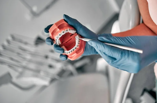 Dentista Feminina Segurando Uma Amostra Dentes Mandíbula Consultório Odontológico Treinamento — Fotografia de Stock