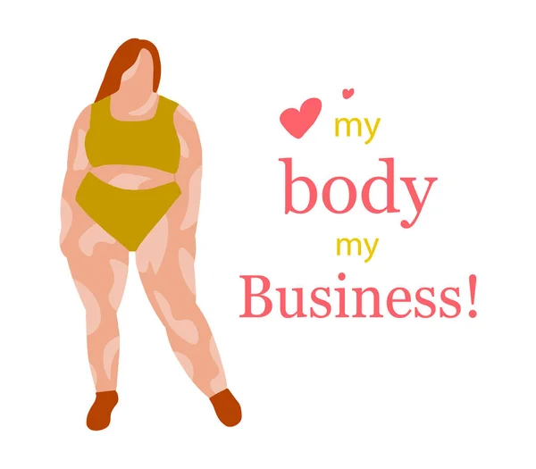Body Positieve Concept Banner Vitiligo Depigmentatie Huidziekte Zelfzorg Liefde Gezondheidszorg — Stockvector