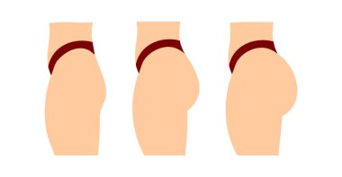 Concept of an increase in the buttocks. Vector concept illustration isolated on white background, side view profile. Flat women butt set in bikini.