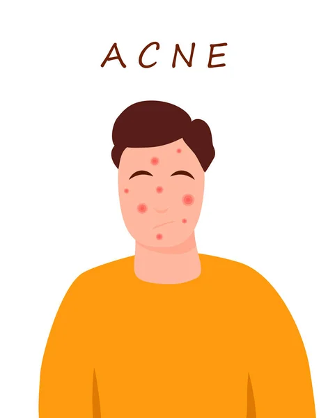 Cartoon Teenage Character Acne Skin Skin Problems Concept Colorful Vector — ストックベクタ