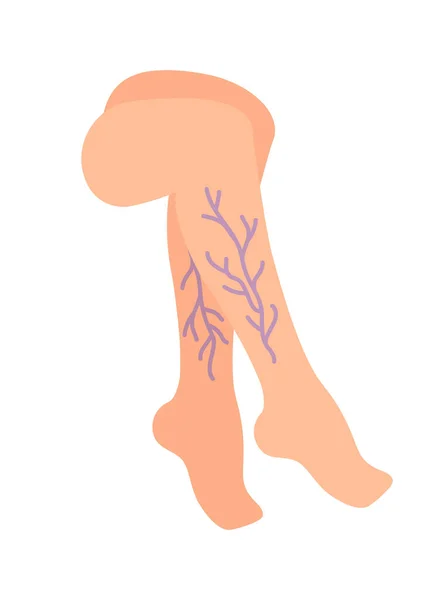 다리에 혈관이나 정맥이요 벡터의 그림은 배경에 분리되어 — 스톡 벡터