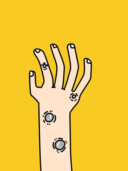 Varíola Homem Mão Desenhos Animados — Fotografia de Stock