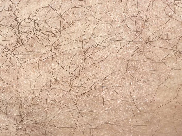 Close Rash Skin — Stock Photo, Image