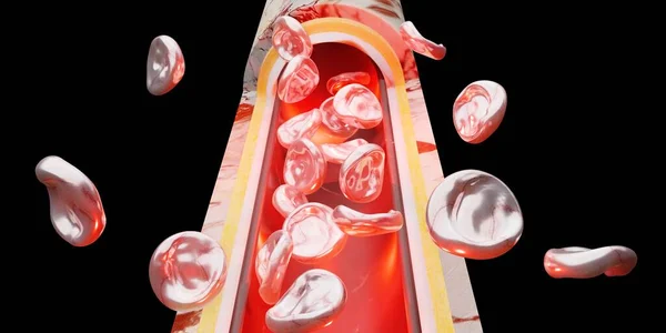 Pele Camada Glóbulos Vermelhos Veia Cirurgia Vascular Ilustração — Fotografia de Stock
