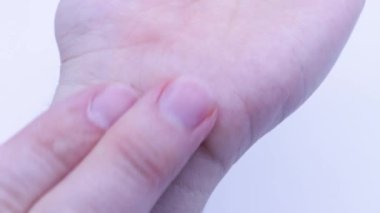 Spor uygulaması nedeniyle bilekte eklem efüzyonu.