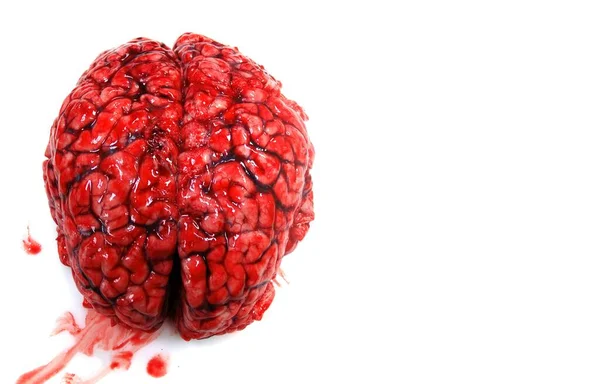 A real bloody human brain isolated on white background