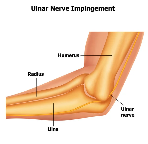 İnsan Ulnar siniri ve kübital anatomi çizimi