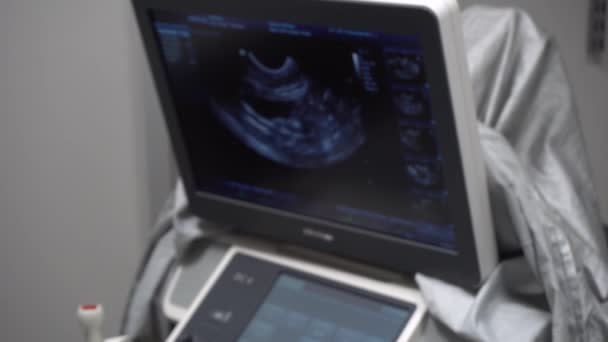 Monitor para exame de ultra-som no consultório de veterinários, ultra-som da cavidade abdominal de um gato, monitor de ultra-som — Vídeo de Stock