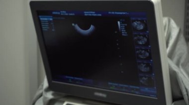 Veteriner ofisinde ultrason muayenesi için monitör, kedinin karın boşluğunun ultrasonu, ultrason monitörü.