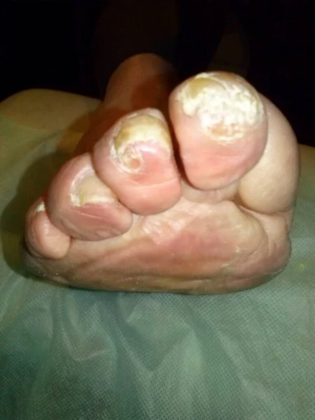 foot and bones of the feet of the woman\'s hand on the belly