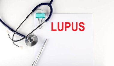 Kağıda steteskopla yazılmış LUPUS metni. Tıbbi konsept.