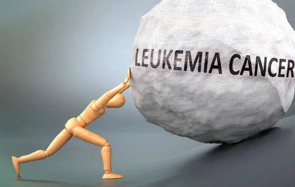 Cáncer Leucemia Representación Impresión Presentación Esta Condición Mostró Modelo Madera — Foto de Stock