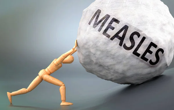 Measles Зображення Враження Представлення Цього Стану Показано Дерев Яною Моделлю — стокове фото