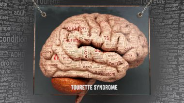 Tourette sendromu anatomisi. İnsan beynindeki sebep ve etkiler Tourette sendromunun karmaşıklığını ve insan zihni ile ilişkisini ortaya çıkarıyor. Sanat kavramı, 3D illüstrasyon