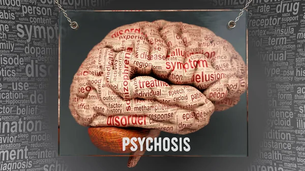 Anatomía Psicosis Sus Causas Efectos Proyectados Cerebro Humano Revelan Complejidad —  Fotos de Stock