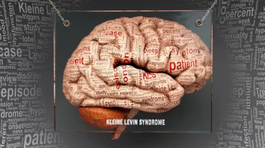 Kleine levin sendromu anatomisi. İnsan beynindeki sebep ve etkiler Kleine levin sendromu karmaşıklığını ve insan zihni ile ilişkisini ortaya çıkarıyor. Sanat kavramı, 3D illüstrasyon