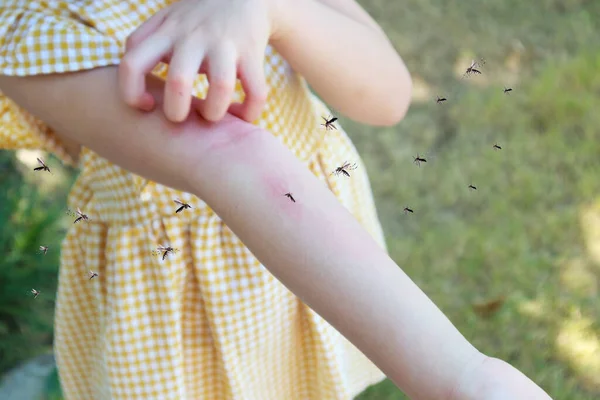 Κοριτσάκι Έχει Δερματικό Εξάνθημα Αλλεργία Και Φαγούρα Στο Χέρι Της — Φωτογραφία Αρχείου