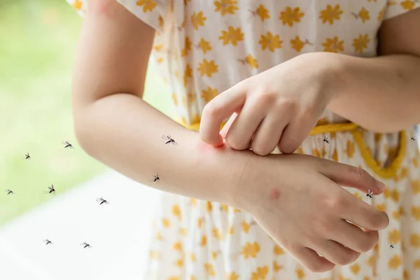 Niña Tiene Erupción Piel Alergia Picazón Brazo Por Picadura Mosquito — Foto de Stock