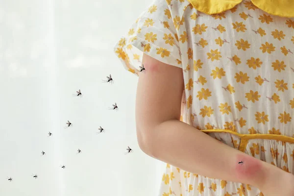 Liten Flicka Har Hudutslag Allergi Och Klåda Armen Från Myggbett — Stockfoto