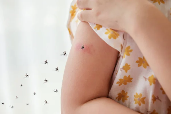 Little girl has skin rash allergy and itchy on her arm from mosquito bite