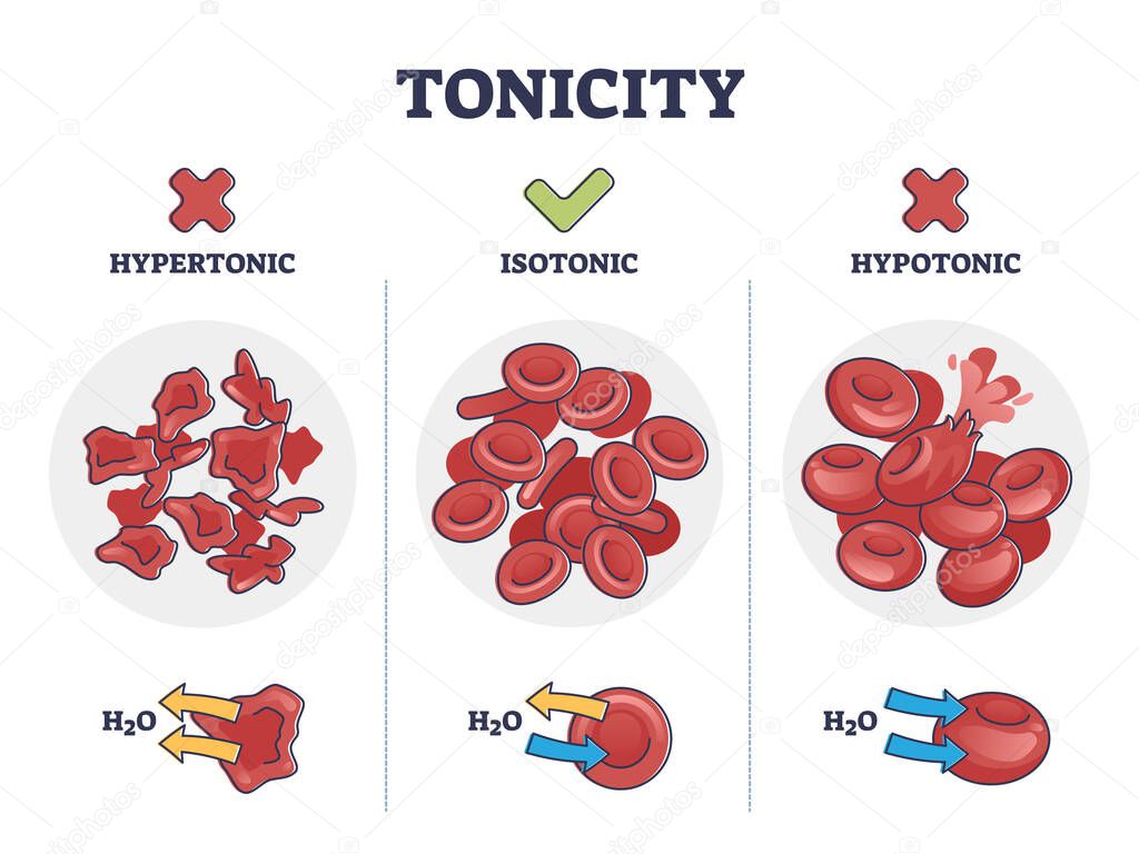 Tonicity as osmotic hypertonic, isotonic, hypotonic pressure outline diagram