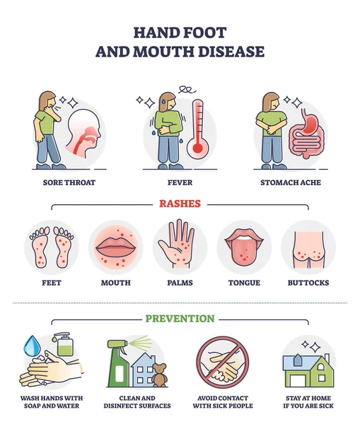 Hand, foot and mouth disease with rashes and how to avoid outline diagram — стоковый вектор