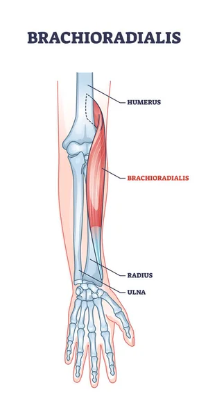 Brachioradialis muskel medicinsk plats med anatomiska ben skiss — Stock vektor