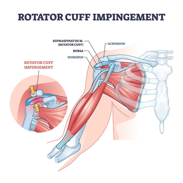 Golpe del manguito rotador y diagrama anatómico del contorno muscular del hombro — Archivo Imágenes Vectoriales