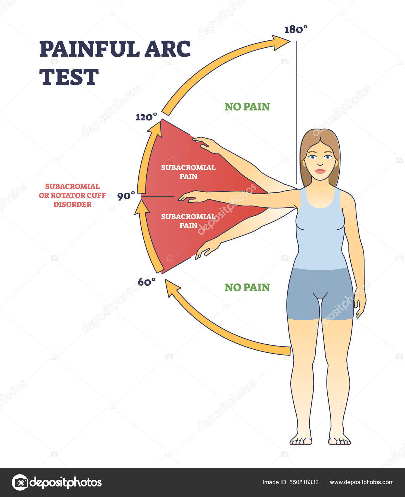 Rotator Cuff Injuries Explained Rotator Cuff Injuries, Shoulder And