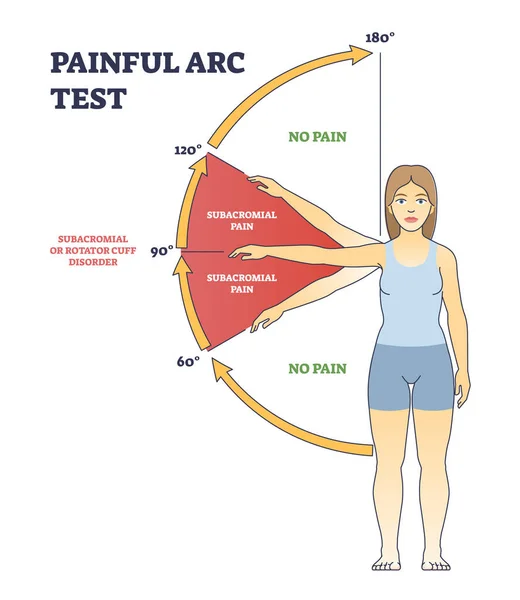 Test d'arc douloureux et schéma de diagnostic médical du syndrome de physiopédie — Image vectorielle