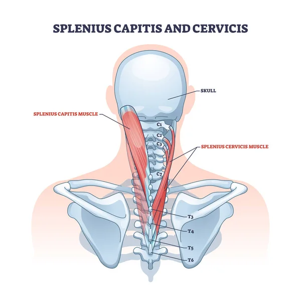 Capite esplênica e localização do músculo cervicis no diagrama do contorno do pescoço humano —  Vetores de Stock