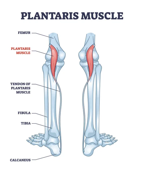 Plantaris izom, mint láb felületes hátsó rekesz vázlat diagram — Stock Vector