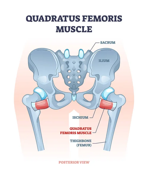 Quadratus femoris músculo como la cadera y la ingle rotador articulación esquema diagrama — Vector de stock