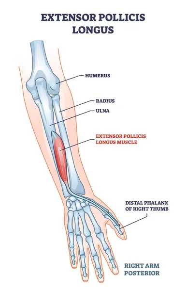 Extensor pollicis longus muscle location with arm skeleton outline diagram —  Vetores de Stock