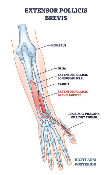 Extensor pollicis brevis muscle location with arm skeleton outline diagram —  Vetores de Stock