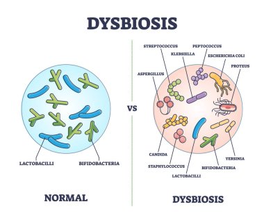 Dysbiosis versus normal gut or tract microflora with bacteria outline diagram