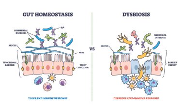 Gut homeostasis and dysbiosis immune response differences outline diagram clipart