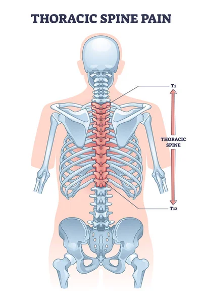 Dor Coluna Torácica Como Diagrama Contorno Inflamação Muscular Tecidos Moles — Vetor de Stock