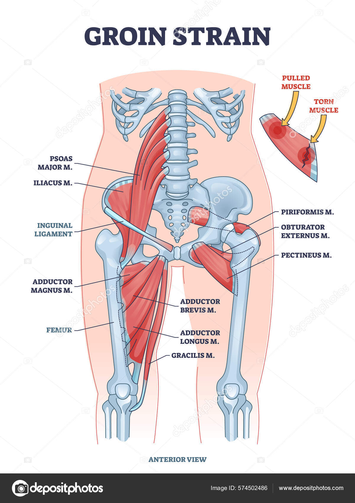 Groin Stam Trauma Och Drog Eller Slet Muskelskada Anatomi Skissera