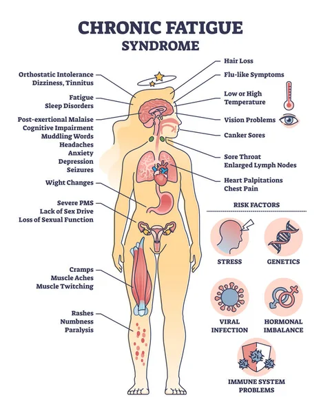 具有症状和危险因素的慢性疲劳综合征列表示意图 带有医学问题解释和能量损失的标签教育方案引起病媒说明 疲劳的影响 — 图库矢量图片