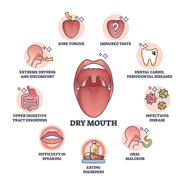 Dry Mouth Xerostomia Salivary Glands Saliva Problem Outline Diagram Labeled — Archivo Imágenes Vectoriales