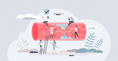 Hastalığı ya da kanı tespit etmek için yüksek kolesterol muayenesi küçük bir insanın hayatını riske atar. Kalp krizi farkındalığı yüksek basınç ve sağlıksız atardamar illüstrasyonundan kaynaklanıyor. Kardiyolog hasta sağlığı hizmetleri